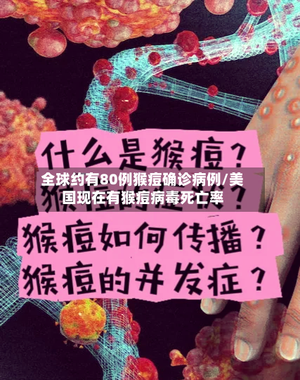 全球约有80例猴痘确诊病例/美国现在有猴痘病毒死亡率
